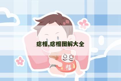痣相,痣相图解大全 痣相,痣相图解大全