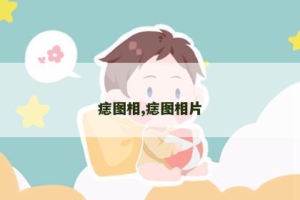 痣图相,痣图相片 痣图相,痣图相片