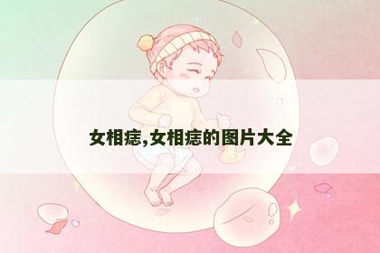 女相痣,女相痣的图片大全 女相痣,女相痣的图片大全