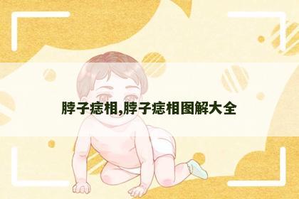 脖子痣相,脖子痣相图解大全 脖子痣相,脖子痣相图解大全